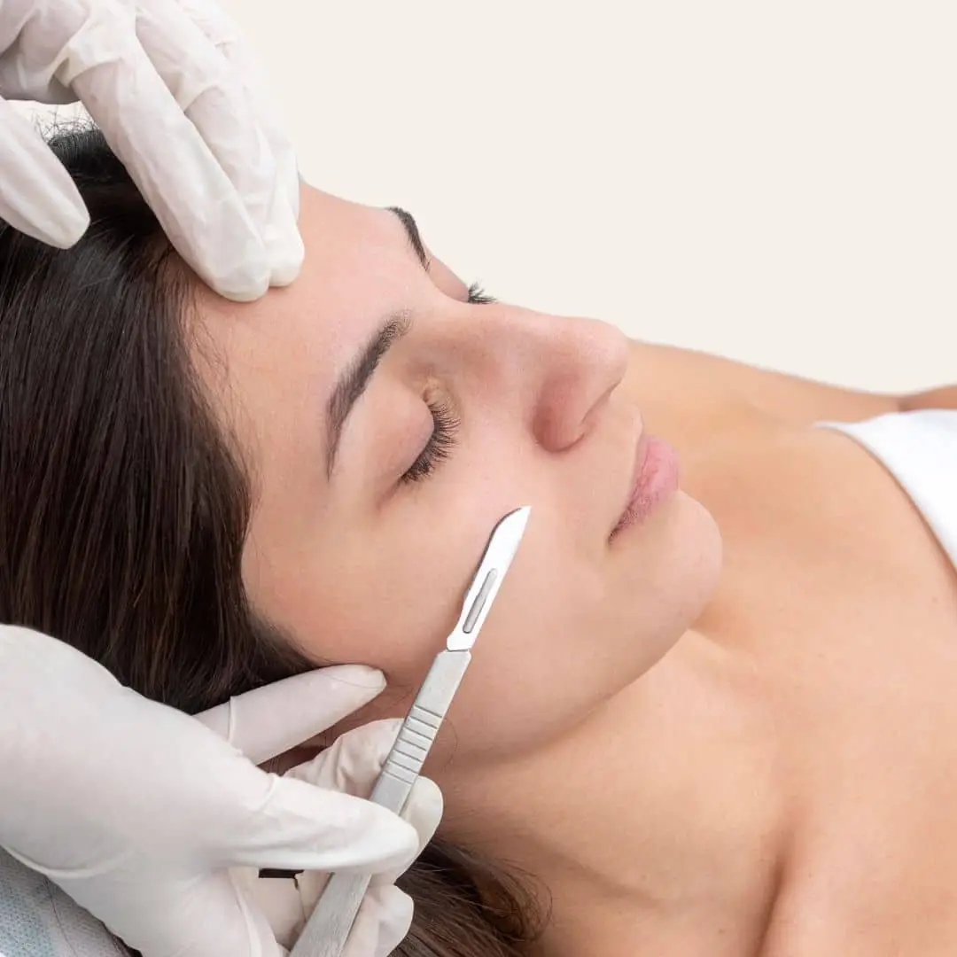 Dermaplaning in antwerpen