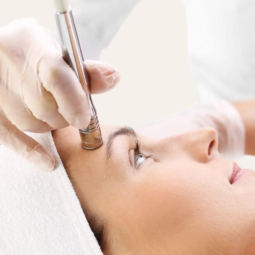 Microdermabrasie in Antwerpen