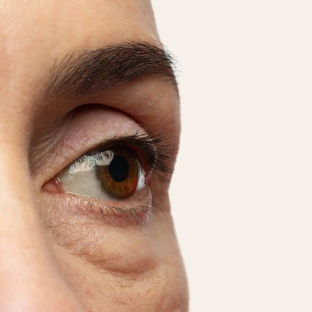 Oogwallen Verwijderen in Antwerpen