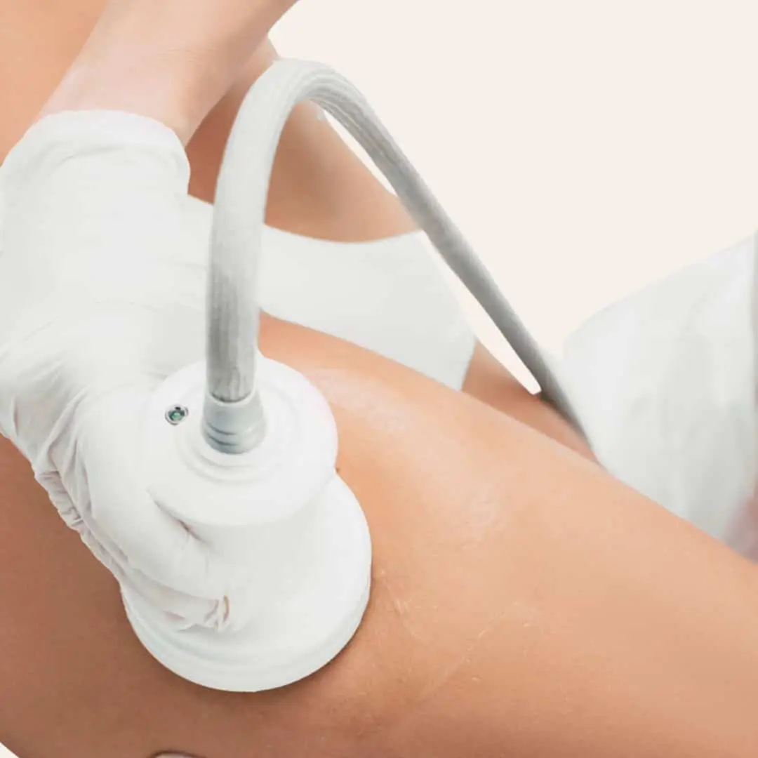 Vacuumtherapie behandeling in Antwerpen